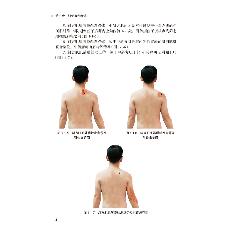 醉染图书阿是穴今释·软组织疼痛治疗点临床应用9787117338高清大图