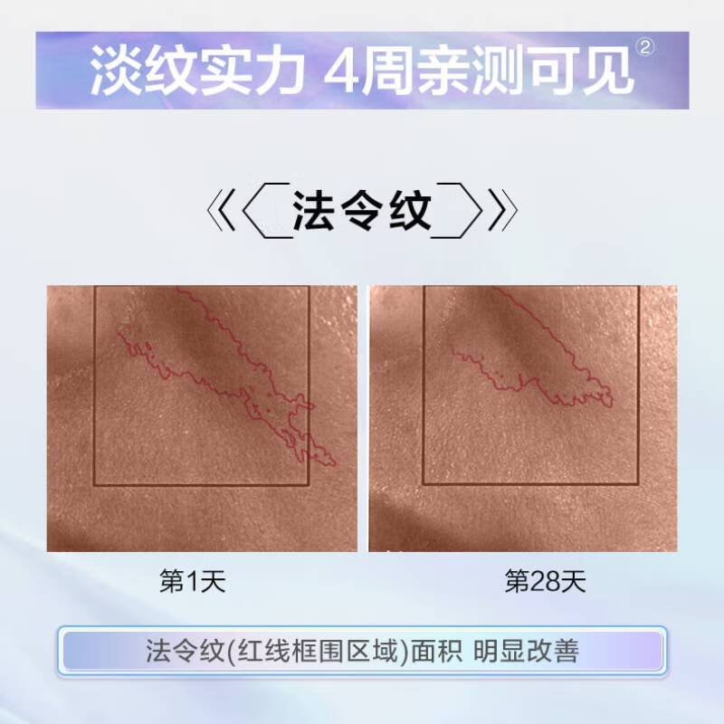 松下(panasonic)微电流美容仪微电流家用眼部面部淡纹提拉瘦脸开穴点穴提拉抗老礼盒装脸部美容器 EH-GR11