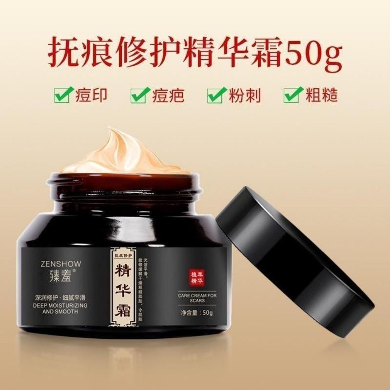 去妊娠纹产后修复霜去除肥胖纹生长纹紧致肚皮孕妇预防消除妊娠纹 修复霜(1瓶)