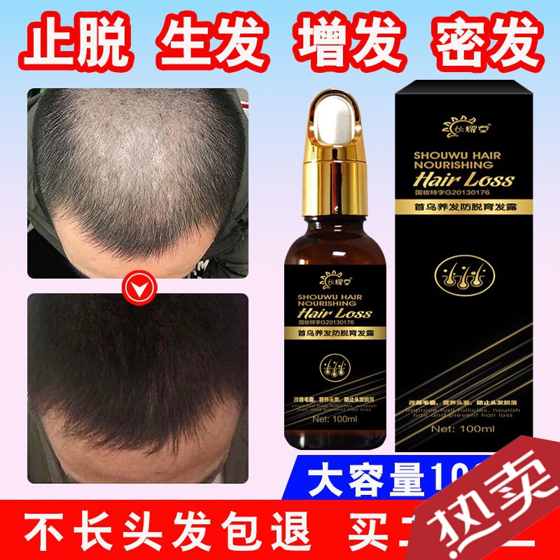 [苏宁专营]拍2发4育发液斑秃生发液防脱发生发增发液密发生发水剂头发