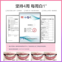 爱博尔(AIBOER)儿童电动牙刷 33000转 声波震动 电动牙刷儿童 软毛3-6-12岁让宝宝爱上刷牙 王子蓝2刷头
