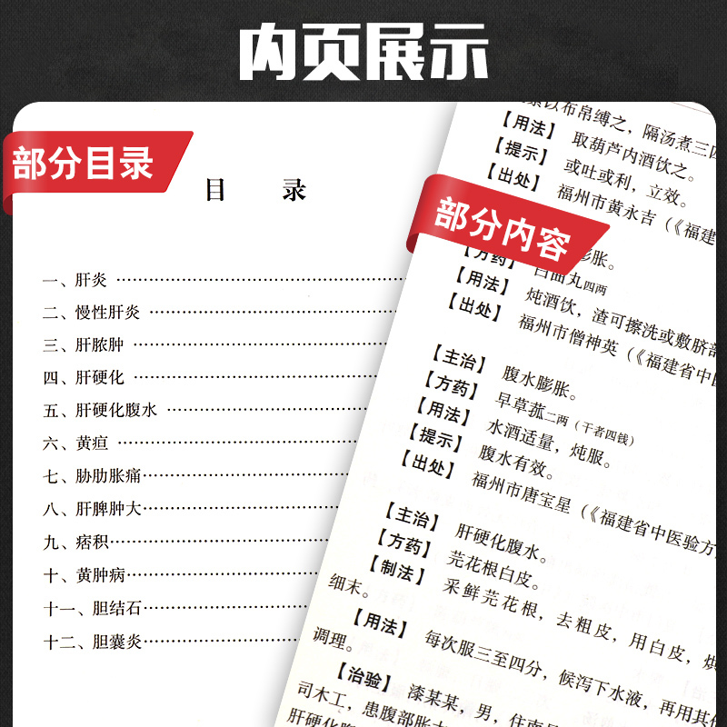 [正版]全国中医献方类编辑消化系统疾病肝胆病慢性肝炎肝脓肿肝硬化胆结石黄疸李占东著9787507757460学苑出版社