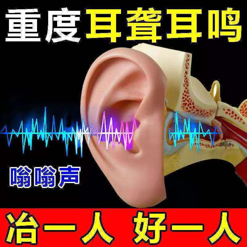 [一滴就灵]耳聋耳鸣神经性耳鸣滴耳液特效耳背嗡嗡响耳朵听不清 耳鸣耳聋[特效] 1盒体验装