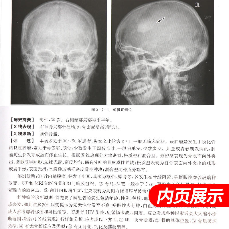 [醉染正版]正版 X线读片指南 第4版 第四版医学检查鉴别放射诊断学系列图谱邢伟邱建国精装实用临床影像诊断报告丛书籍X光高清大图