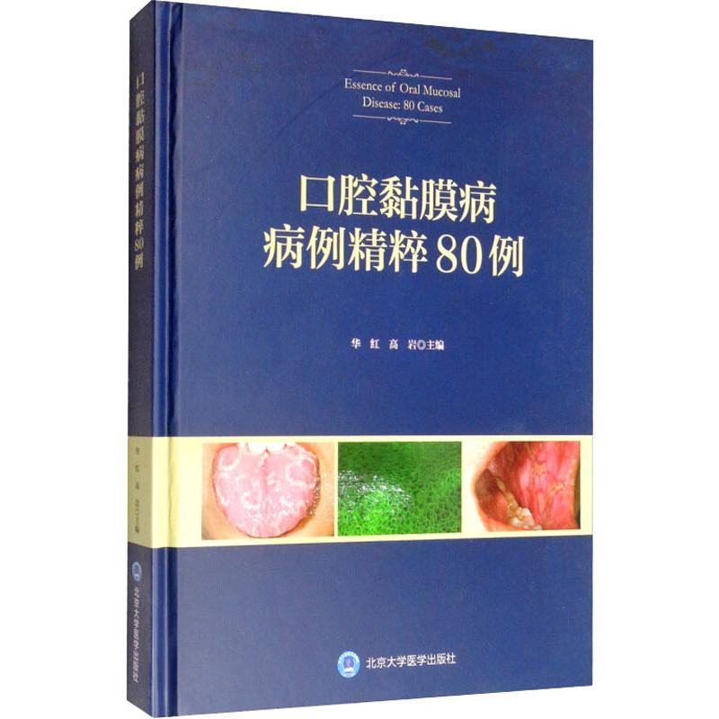 【M】口腔黏膜病病例精粹80例-9787565919824