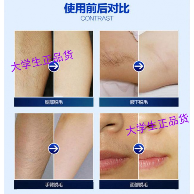 瑟萱 Cersuan 脱毛 苏宁优选 明星同款脱脸毛膏脸部永久性脱毛膏男女胡须去除脸毛嘴唇永久脸部小胡子 价格图片品牌报价 苏宁易购崟鑫美妆专营店