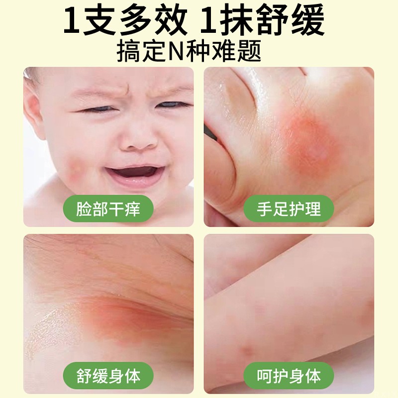 紫草膏婴儿专用蚊虫蚊子叮咬止痒消肿清凉舒缓棒便携非青草膏·达人专享高清大图