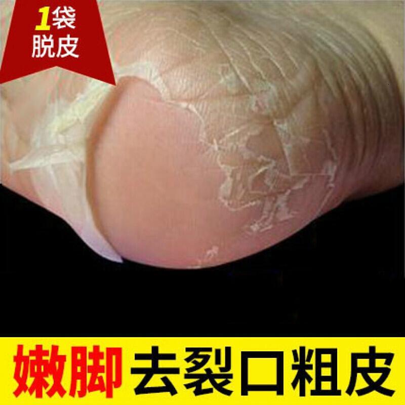 番茄派 Tomato Pai 足膜 足贴私人定制去死皮老茧脚底脱皮足膜嫩脚保湿后跟干裂脚模足贴 价格图片品牌报价 苏宁易购佳琪美妆专营店