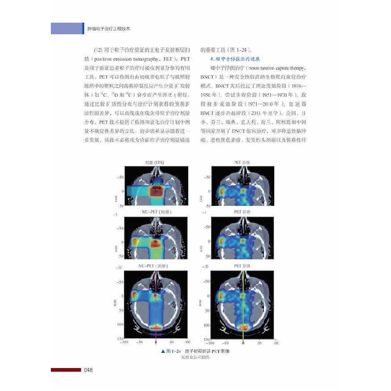 正版新书]肿瘤粒子治疗工程技术王学武,唐劲天9787504692337高清大图