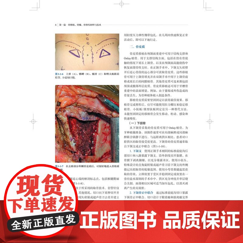 颅颌面外科学肿瘤骨畸形与创伤 上海科学技术出版社颅颌面创伤肿瘤正颌面部美容外科中骨骼软组织矫治方法技术高清大图