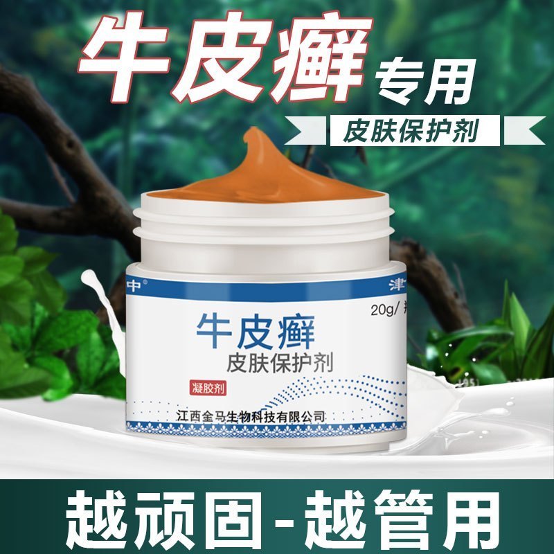 周郎中牛皮癣银屑专用手足癣大腿内侧股部全身皮肤瘙痒外用止痒
