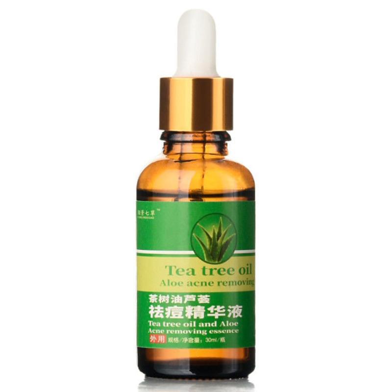 祛痘产品 精华液青春痘学生去痘印神器茶树精油印痘坑修复芦荟胶 1瓶装 [祛痘精华液]