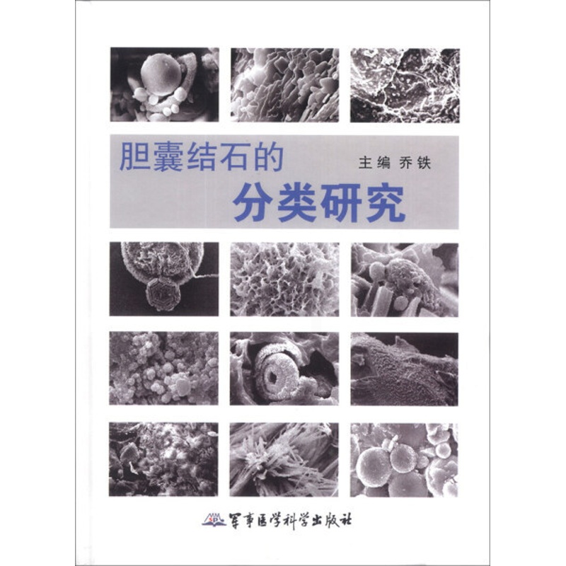 [醉染正版]BW 胆囊结石的分类研究 9787516303085 军事医学科学 无高清大图