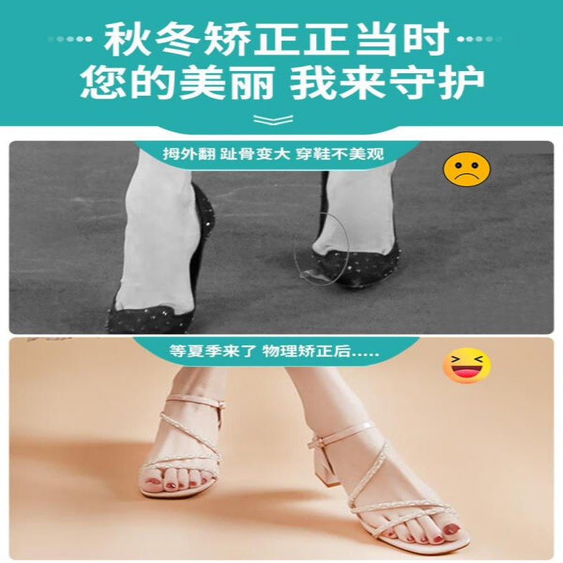 脚趾矫正器拇指外翻矫正大母脚趾纠正神器女士脚骨突出 2025专利款[ 无痛气动矫正+可调节角度]单只装 均码