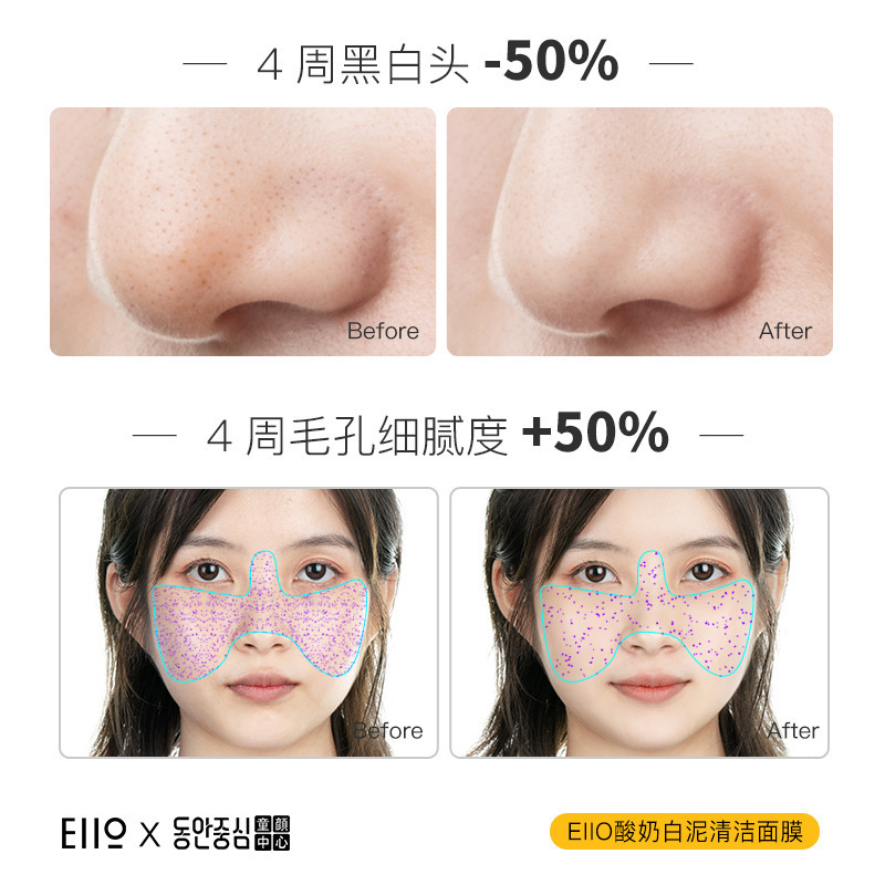 eiio清洁面膜泥膜深层收缩毛孔去黑头粉刺男女油皮补水涂抹式白泥