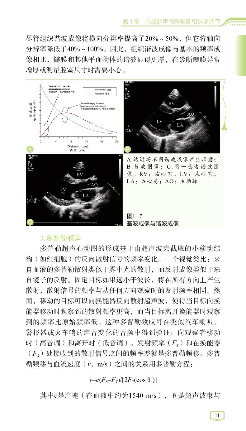心脏超声解剖及临床应用手册/基层超声医师必读丛书
