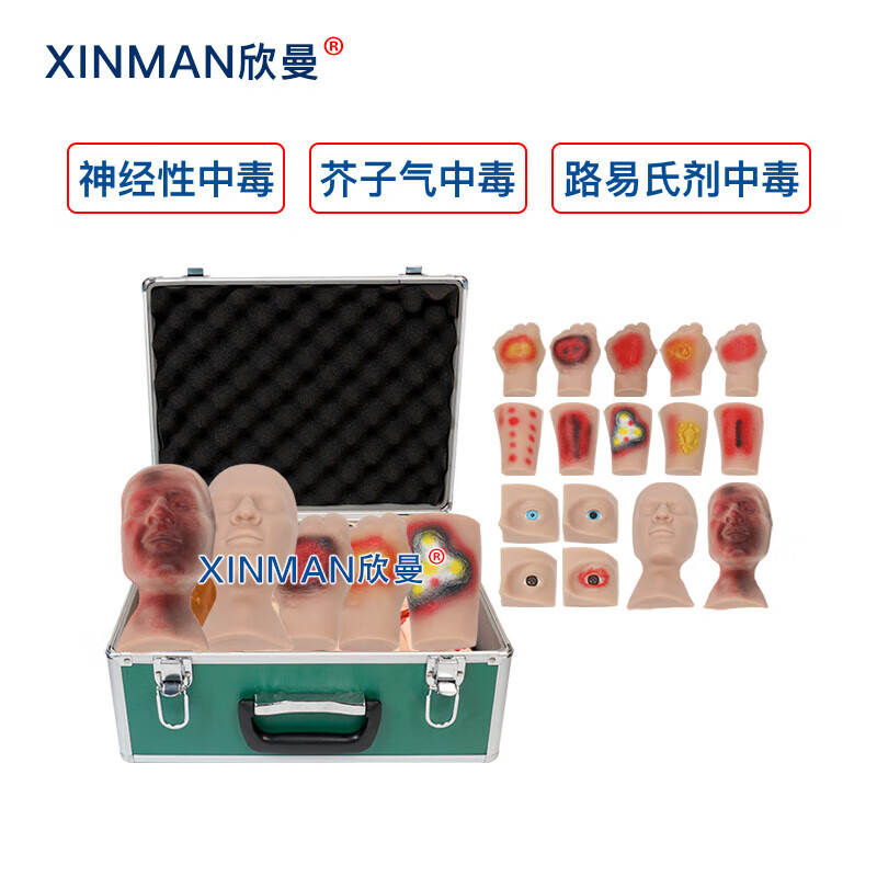 欣曼科教 人员中毒仿真模型 神经性中毒 芥子气中毒 路易氏剂中毒 教学用模型XM-SQ16A高清大图