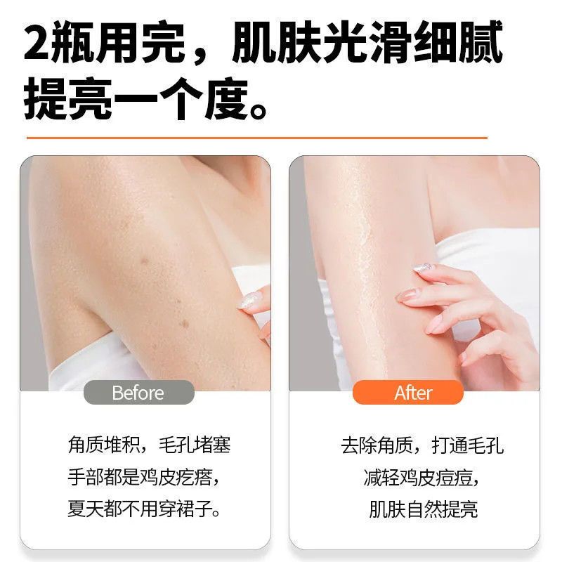 石榴籽磨砂膏200g 一盒 石榴籽磨砂膏身体乳全身去鸡皮肤去角质嫩白保湿沐浴盐男女通用