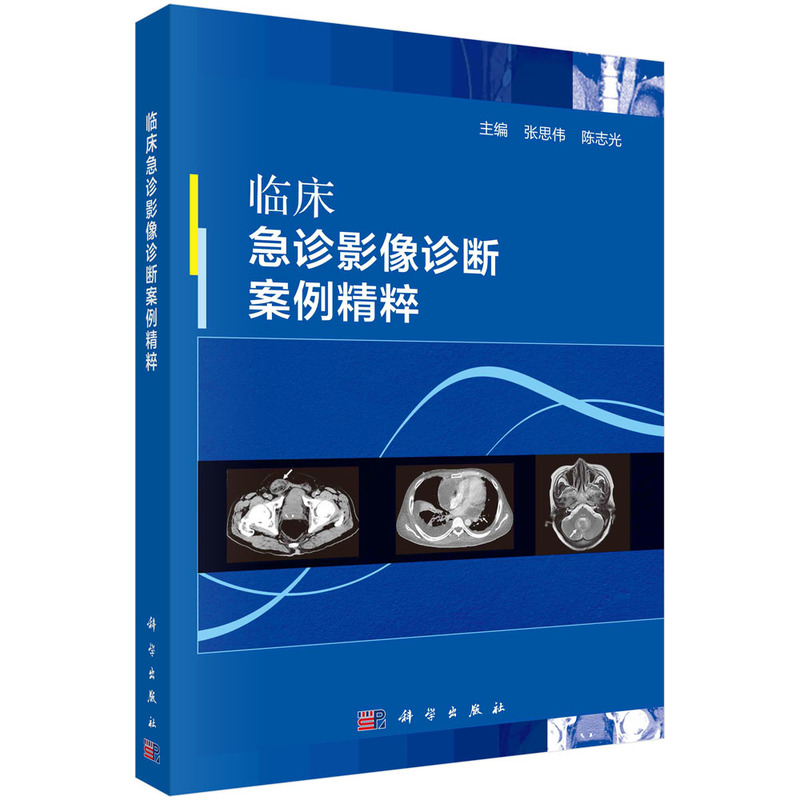音像临床急诊影像诊断案例精粹张思伟,志