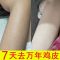 [永久去鸡皮]乳木果磨砂膏去鸡皮疙瘩角质死皮身体全身美白学生 一支去角质80克[面部用]