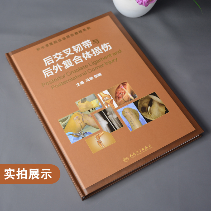 [正版]医学书后交叉韧带与后外复合体损伤高清大图