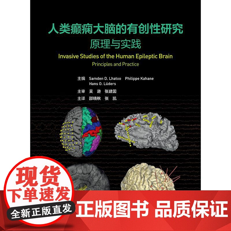 人类癫痫大脑的有创性研究:原理与实践高清大图