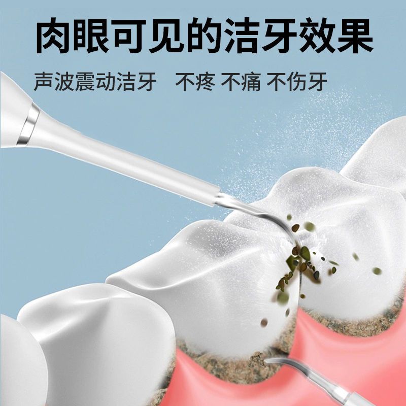震动电池款[1个头] 超声波洁牙器成人冲牙器水牙线去牙结石去除器电动牙刷洗牙神器