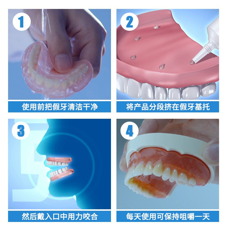 雅克菱(Y-Kelin) 假牙安固膏40g/支*3支 义齿安固膏 假牙松动安固稳固粘贴合膏剂帮助假牙粘着贴合
