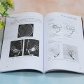 【正版】脑动脉瘤旁路手术 孙正辉 编 外科学参考资料图书 医学类专业书籍