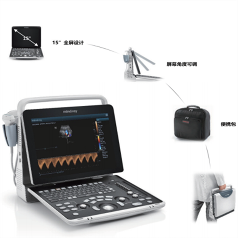 迈瑞 z50便携式彩色多普勒超声系统