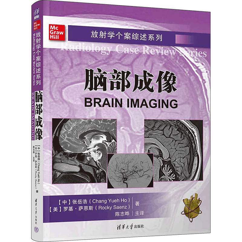 [M]放射学个案综述系列 脑部成像-9787302645269图片