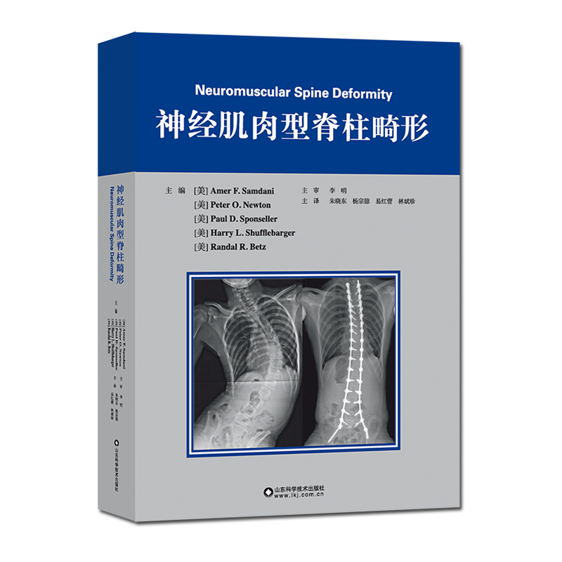 [正版] 神经肌肉型脊柱畸形 内科学脊柱手术神经肌肉型病变脊柱畸形患者外科医生参考用书 山东科学技术出版社97875高清大图