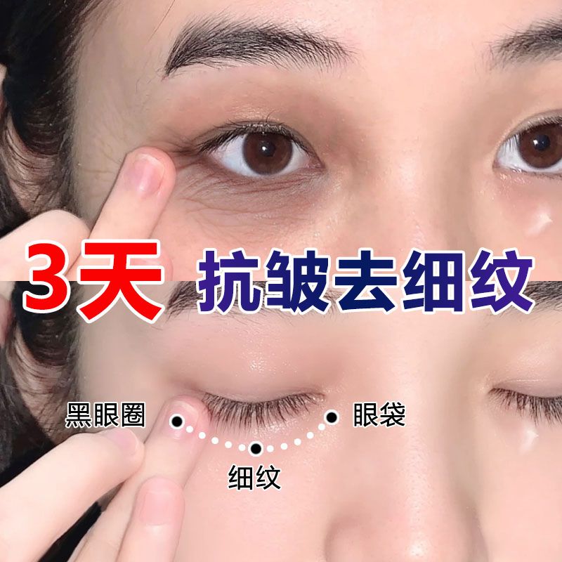 眼霜改善细纹黑眼圈眼袋脂肪粒神器提拉紧致抗皱保湿学生女男>800_800