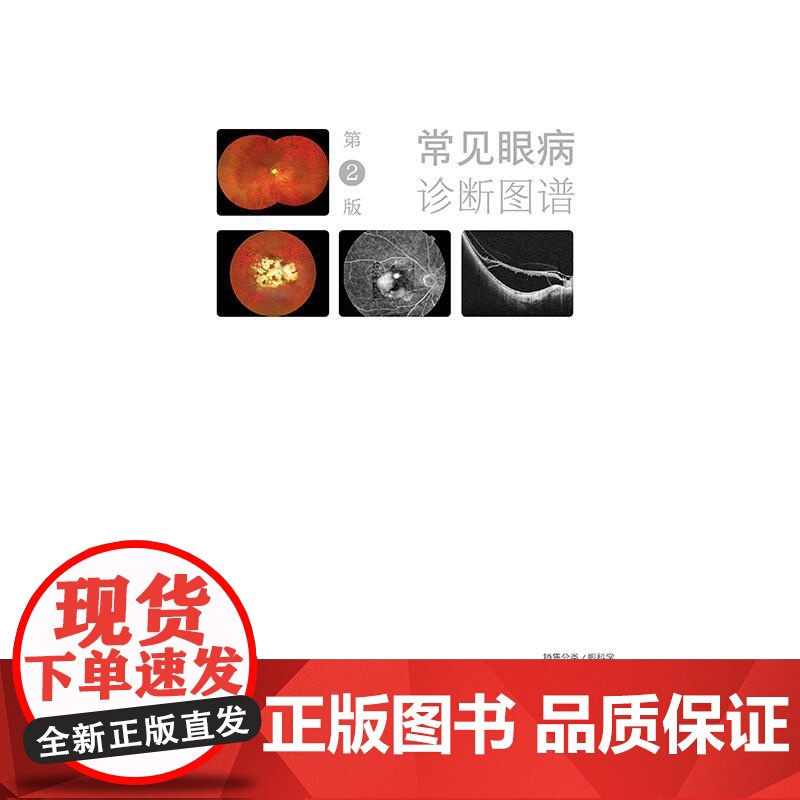 常见眼病诊断图谱 第2版 闵寒毅 主编 眼科实用解剖 眼睑病 泪器病 结膜疾病 结膜松弛症 角膜疾病9787117372高清大图
