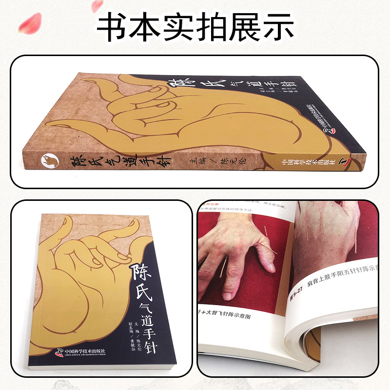[正版]陈氏气道手针 陈元伦 主编 常见病特效针方 手针疗法概述 眼干涩及迎风流泪 止咳三针 中国科学技术出版社978