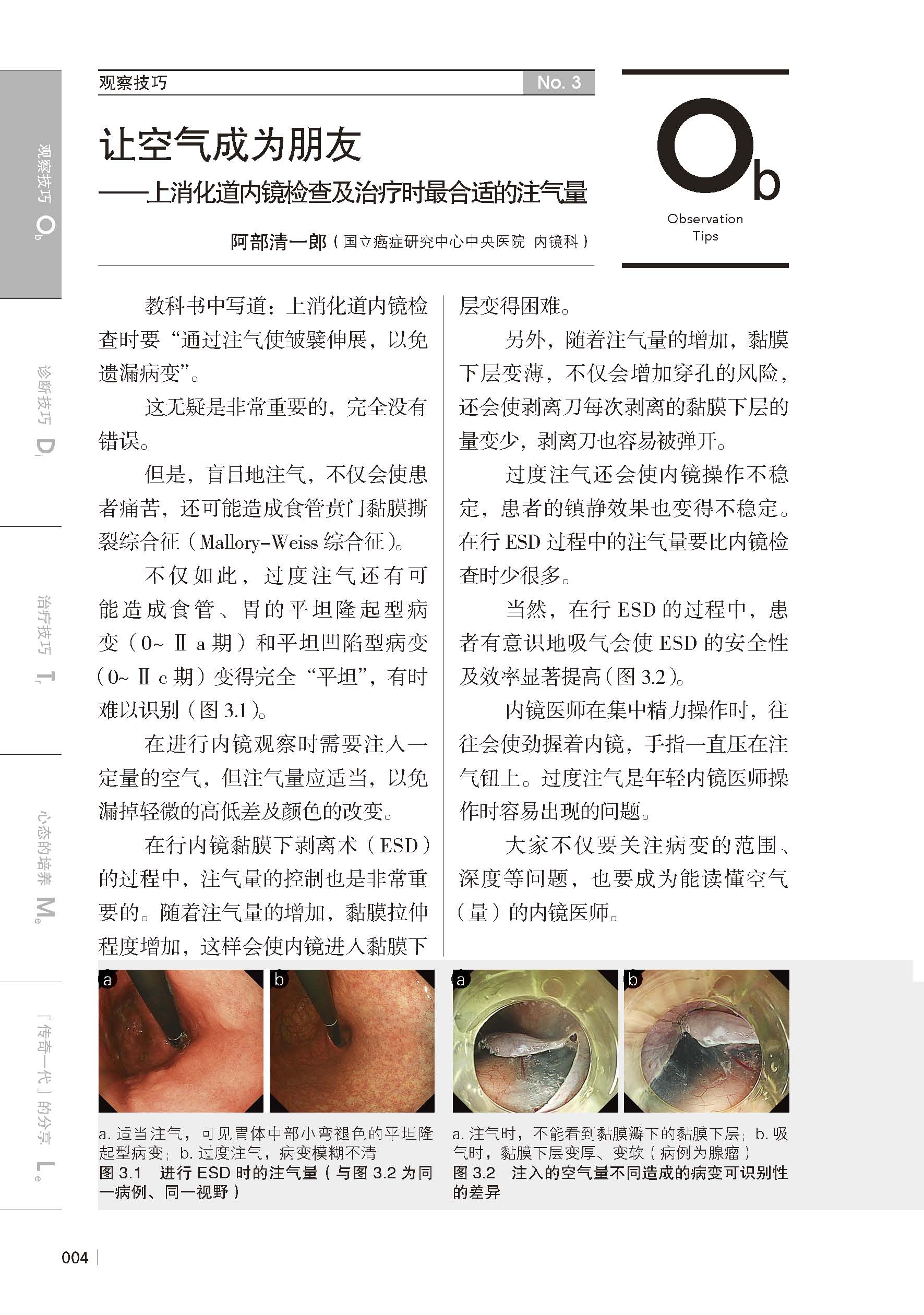 [正版]消化内镜应用提升技巧2 内镜专家未公开的观察 诊断和治疗要点 22个中文字幕操作指导视频 北京科学技术高清大图