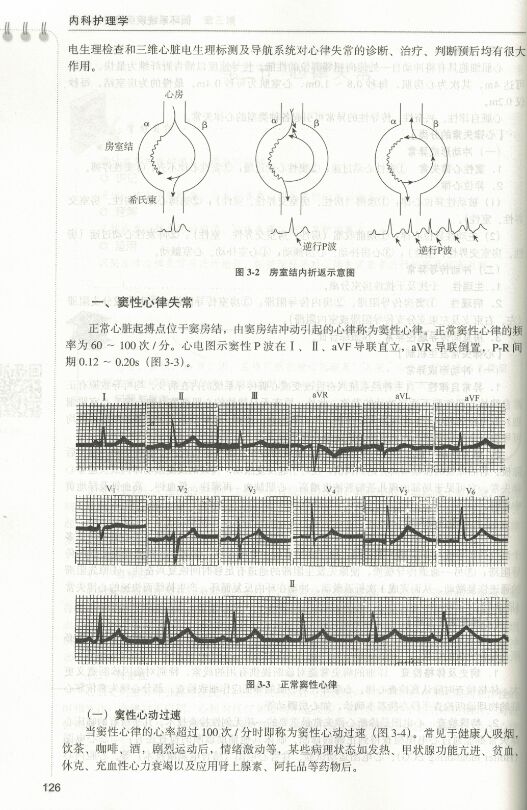 [正版] 内科护理学(第2版)本科护理学类专业用 姚景鹏 吴瑛 陈垦主编 北京大学医学出版社高清大图
