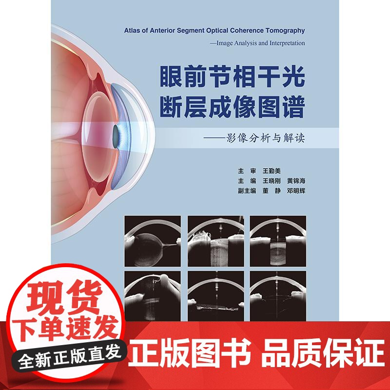 眼前节相干光断层成像图谱影像分析与解读OCT诊疗应用角膜屈光手术虹膜青光眼白内障超声乳化联合房角分离前房炎症晶状体前节光高清大图