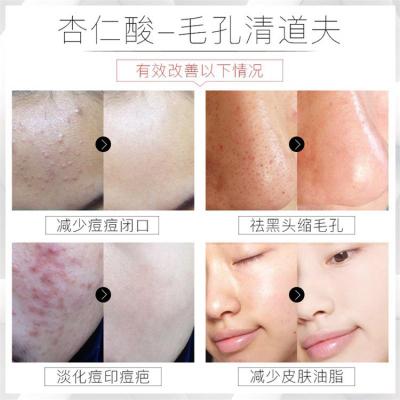 8%杏仁酸精华原液果酸焕肤祛痘面部粉刺痘印护肤品