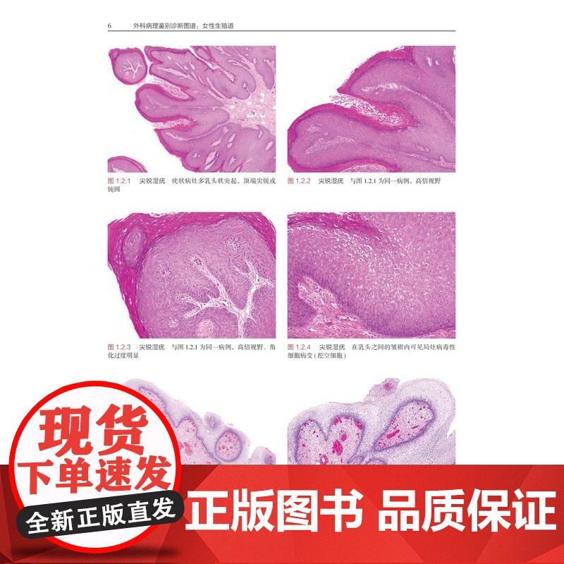 [央视网]外科病理鉴别诊断图谱 女性生殖道 172个鉴别诊断表格和1596幅高清典型病理图片相结合 医学外科学书籍 BJ高清大图