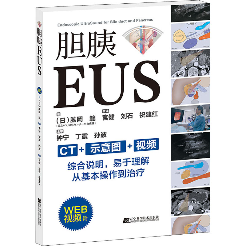 [正版]胆胰EUS (日)肱岡 範 著 宫健,刘石,祝建红 译 内科学生活 书店图书籍 辽宁科学技术出版社高清大图