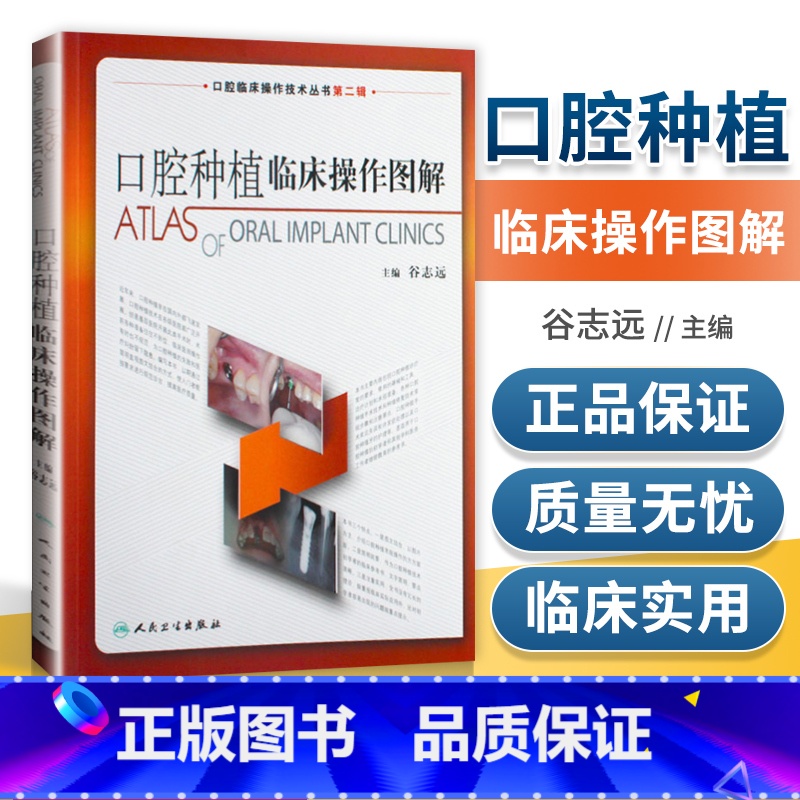 [正版] 口腔种植临床操作图解 拔牙技巧学义齿全瓷修复颌面外科正畸黏膜病学牙髓之路儿童牙科病历根管治疗口腔医学书籍高清大图