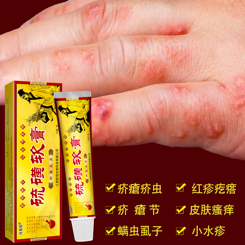硫磺软膏虱私处百部酊乳膏虱手脚小水泡脱皮痒囊瘙痒皮肤疥虫