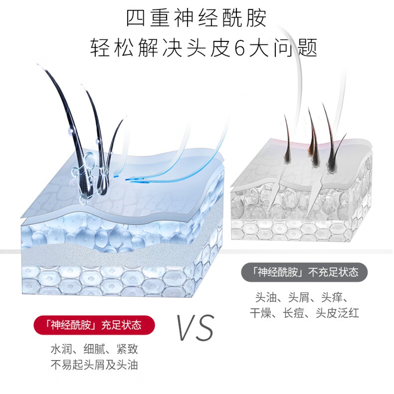 舒蕾头皮专研洗沐礼盒[711ml+711ml]3929-00高清大图