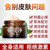 专营）牛皮银屑癣去皮肤皮屑病大腿内侧瘙痒外用药膏止痒膏