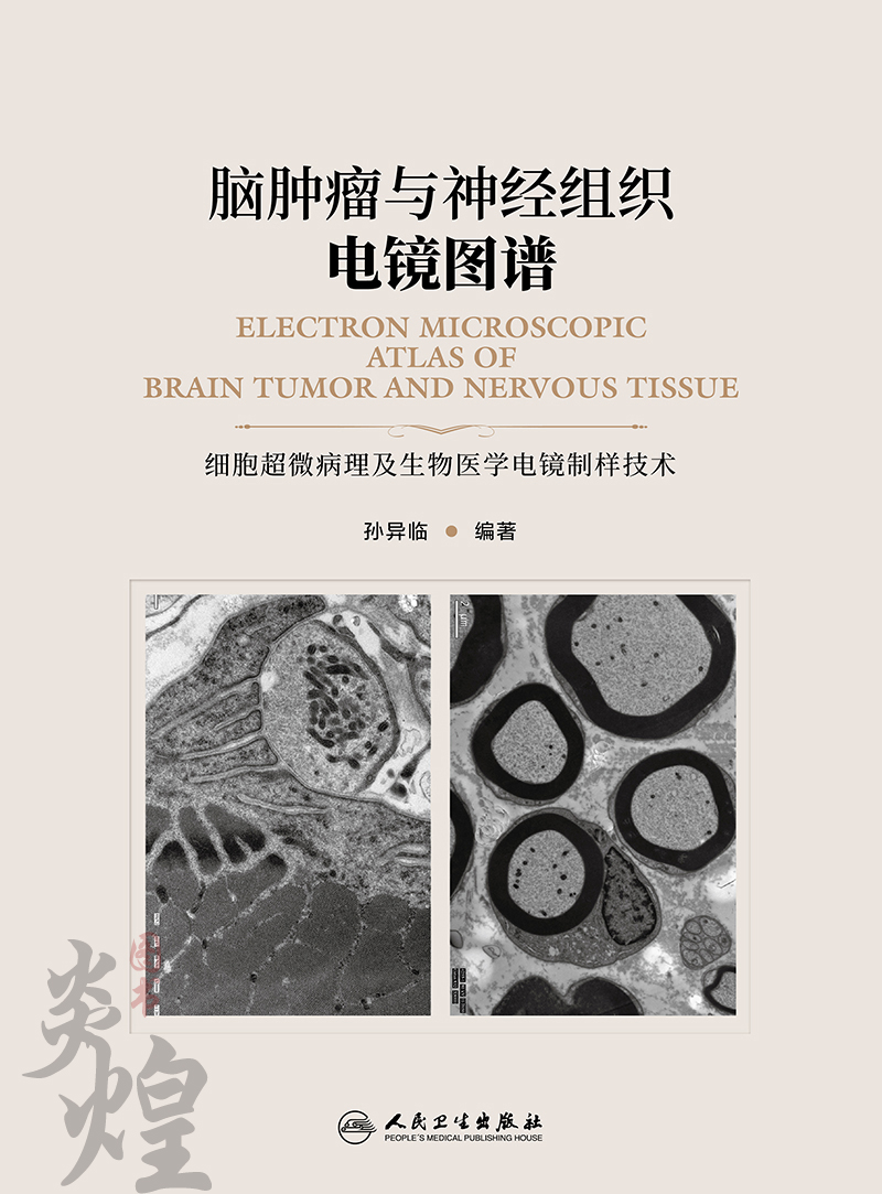 [醉染正版]脑肿瘤与神经组织电镜图谱 孙异临编著 人民卫生出版社9787117269025高清大图