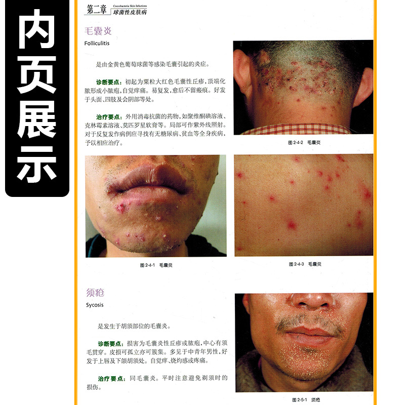 [正版] 中国皮肤病性病图鉴第3版朱学骏病因与实用治疗皮肤性病学医学