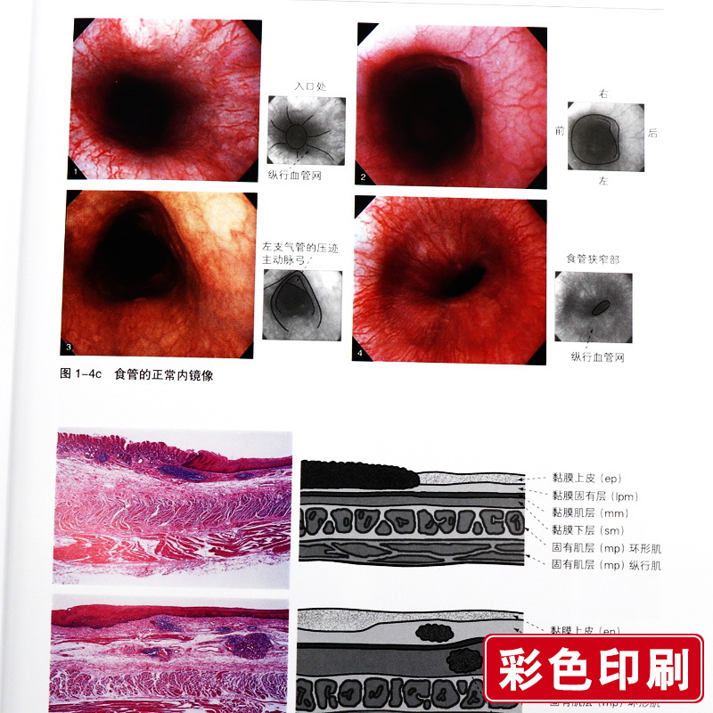 [正版] 内镜诊断与鉴别诊断图谱 上消化道 第二2版 胃镜书 上消化道内镜诊断秘籍 实用消化内科学 临床医学书辽宁科学高清大图