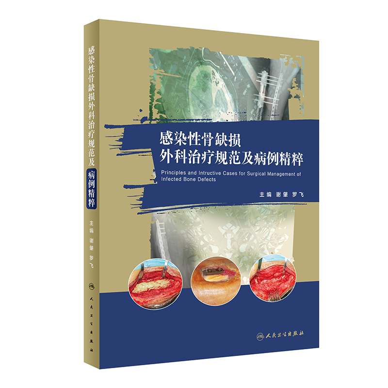 [正版]感染性骨缺损外科治疗规范及病例精粹 谢肇 罗飞 骨缺损缺失骨感染控制死腔处理治疗病例病变骨科学手术外科学修复实高清大图
