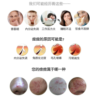 祛痘霜30g 收缩毛孔男女通用 一瓶